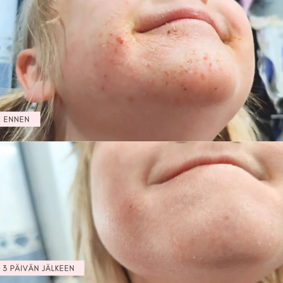 Flow Cosmetics Propolis & Probiotics Rescue Cream, 2 kokoa